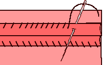 Grfico proceso de sobrehilado